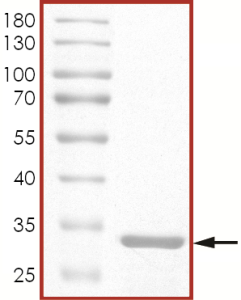 LCK Protein (SH3 domain)